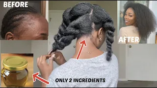 Only 2 ingredients for unstoppable FAST and THICK hair growth 😱 DO NOT WASH IT OUT. Use once a week.