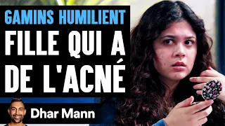 GAMINS HUMILIENT Fille Qui A De L'Acné | Dhar Mann