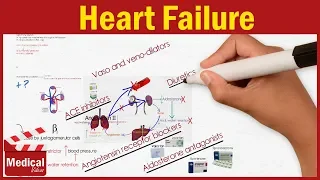 Pharmacology - Heart Failure Symptoms, Causes and Treatment Options FROM A TO Z