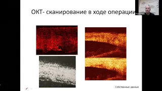 Ежегодная Нижегородская МНПК «Офтальмологические чтения памяти профессора Л.В. Коссовского - 2020»