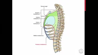 Mediastinal masses | Pathology of mediastinal masses