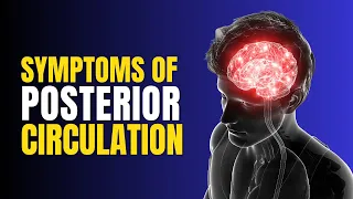 Posterior Circulation Stroke | Recognizing the Silent Symptoms