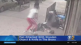 Man Beaten And Stabbed In The Bronx