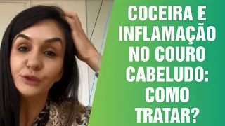 COCEIRA E INFLAMAÇÃO NO COURO CABELUDO: COMO TRATAR?