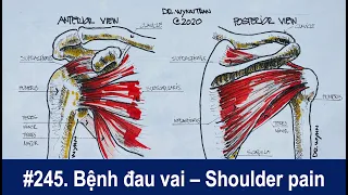 #245. Bệnh đau vai và tổn thương cơ quay khớp vai - Shoulder pain and rotator cuff injury
