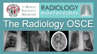 The Radiology OSCE