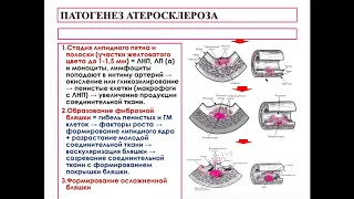 Синдром коронарной недостаточности