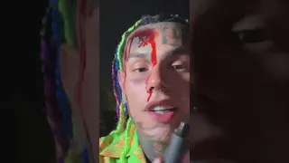 6ix9ine Covered In Blood