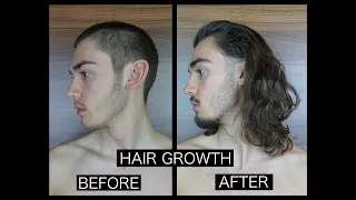 HAIR GROWTH TIME LAPSE - SIDE