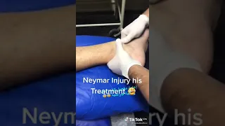 neymar jr injury his treatment