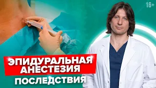 Почему после ЭПИДУРАЛЬНОЙ анестезии БОЛИТ СПИНА и что с этим делать? //16+