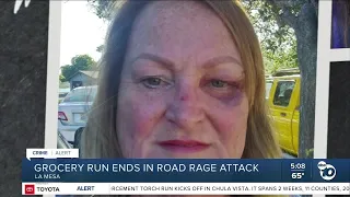 La Mesa woman recounts brutal road rage attack