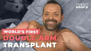 World's First Double Arm Transplant: 'It's Science Fiction'