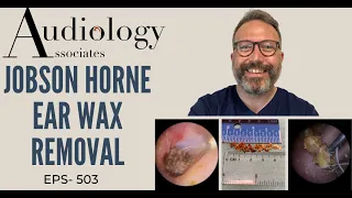 JOBSON HORNE EAR WAX REMOVAL - EP 503