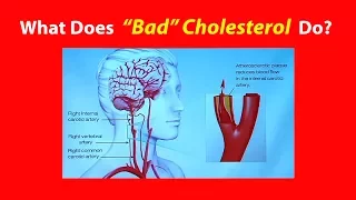 What Does "Bad" Cholesterol Do?