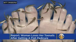 Woman Lost Her Toenails After Fish Pedicure, Say Doctors