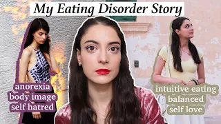 My Eating Disorder Story and How I Overcame It | Anorexia, Bulimia, Modeling and more..