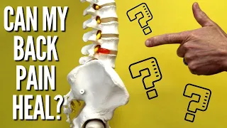 Can My Herniated, Bulging Disc or Sciatica Heal?