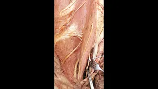 Anatomy of the pelvis #shorts #medicine #doctor #anatomy #medstudent #medschool #resident  #md #med