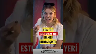 Eda Ece estetik olan yeri bakın neresi çıktı . Yasak elma 155. Bölüm Fragmanı