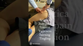 Sciatic Nerve Entrapment at the deep gluteal space (posterior hip)