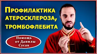 Разжижение крови,  профилактика атеросклероза и тромбофлебита.  Практические советы от Данилы Сусак