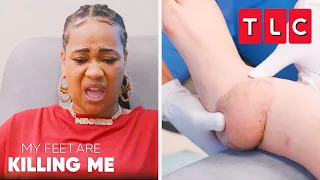 Her Leg Has Been Broken For 12 YEARS!? | My Feet Are Killing Me | TLC