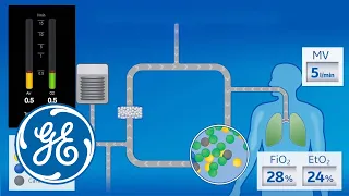 The dilution effect of O2 during the practice of low flow anesthesia | GE Healthcare