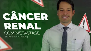 Câncer Renal Com Metástase - Tratamento Ideal