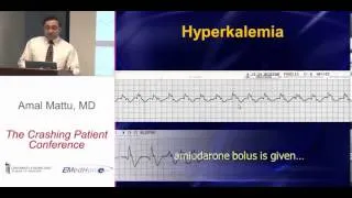 CrashingPatient: Amiodarone...Where's the black box?