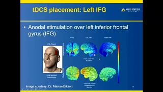 "TDCS in primary progressive aphasia", Kyrana Tsapkini