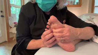 Self Treatment for Hammer Toe and Metatarsalgia
