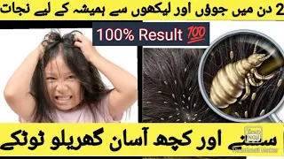 Juon or Likhon se Nijat , Anti Lice Treatment at Home | How to Get Rid of Head Lice. Only 10mintues💯