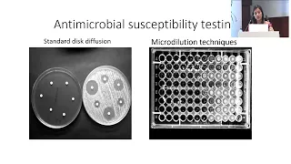 AIOC2024  GP123 Topic  Dr Anu Malik Overview and basic work up of a case of microbial keratitis