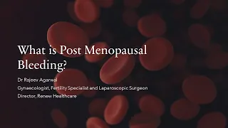 Post Menopausal Bleeding or Bleeding After Menopause - What is it and how should you deal with it?