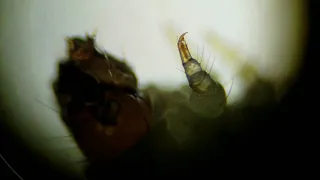 Moth Larva Under Microscope