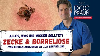 Borreliose