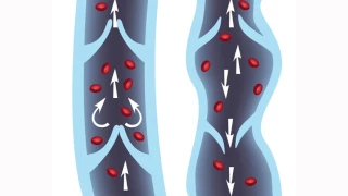 VitaTree Vein and Circulation Formula