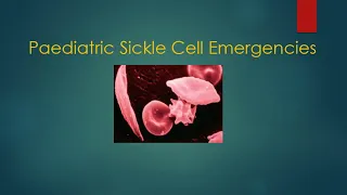 Paediatric Sickle Cell Emergencies