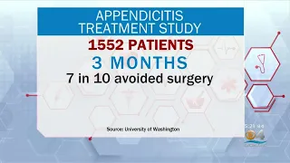 Antibiotics A Possible Alternative For Some Patients Facing Appendectomy