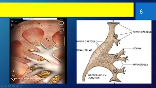 Renal Ultrasound ( anatomy) , DR/AMR SALAH