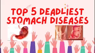Top 5 Deadliest Stomach Diseases || Gastroparesis Signs & Symptoms [PART I]  #nasuea #abdominalpain