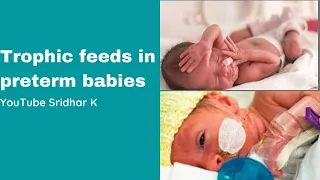 Trophic feeds in preterm babies. What is trophic feeding? Dr Sridhar Kalyanasundaram