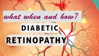 This will  change your perspective about DIABETIC RETINOPATHY!