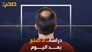 وداعا للصلع.. دراسة طبية تثبت فاعلية أكبر لعلاج تساقط الشعر