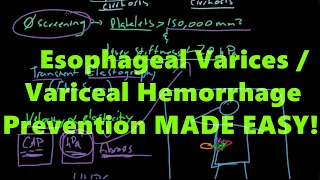Esophageal Varices / Variceal Hemorrhage Prevention MADE EASY!
