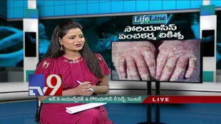 Psoriasis - Panchakarma Treatment - Lifeline - TV9
