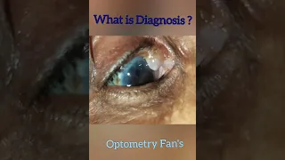 what is an ocular diagnosis?