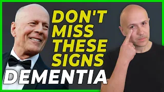 EARLY SIGNS  OF DEMENTIA | HOW TO PREVENT DEMENTIA AND ALZHEIMER? BRUCE WILLIS'S MENTAL DISEASE