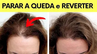 QUEDA DE CABELO EM MULHERES - A forma mais rápida de PARAR e REVERTER